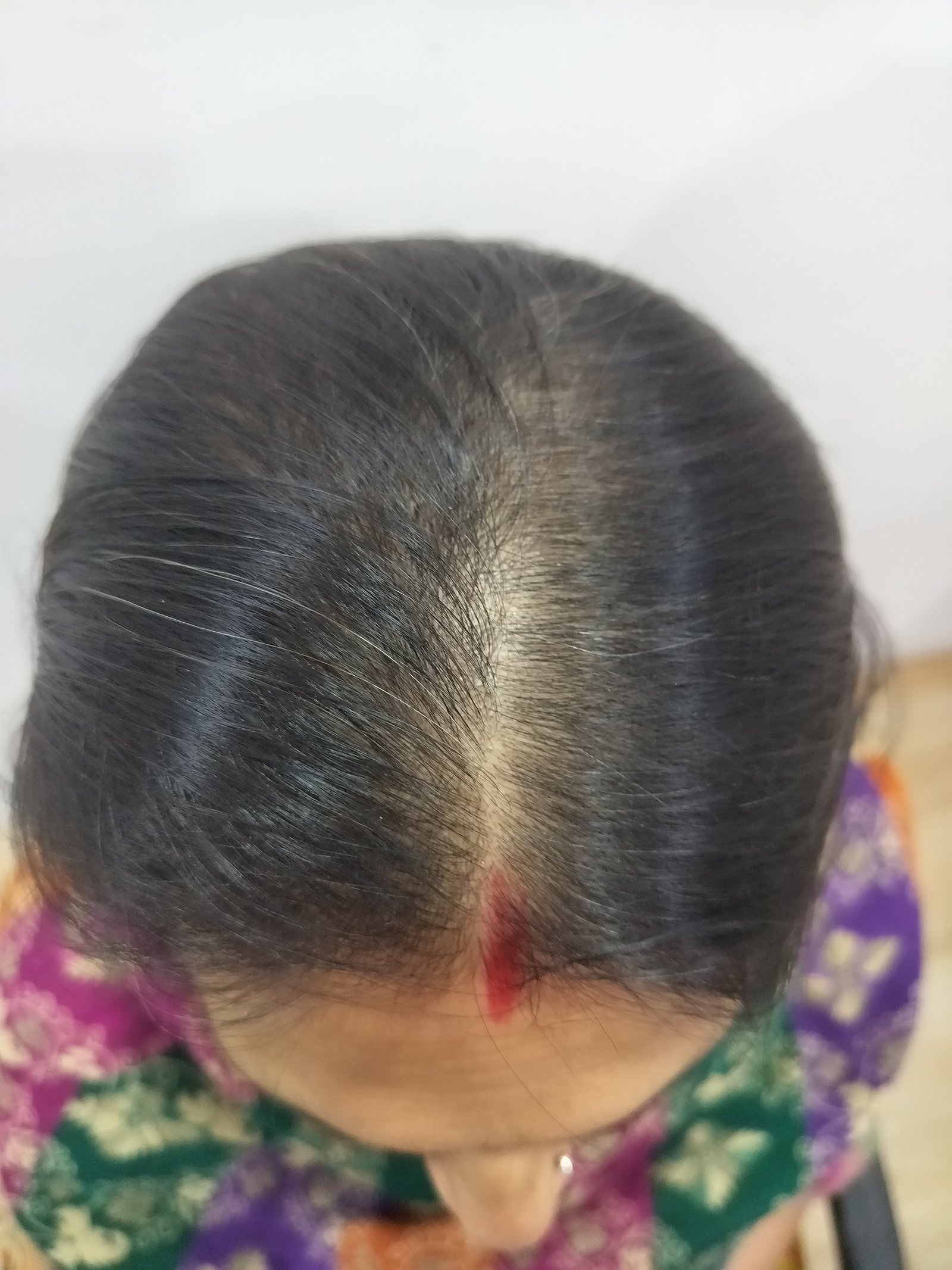 transformation-img-2