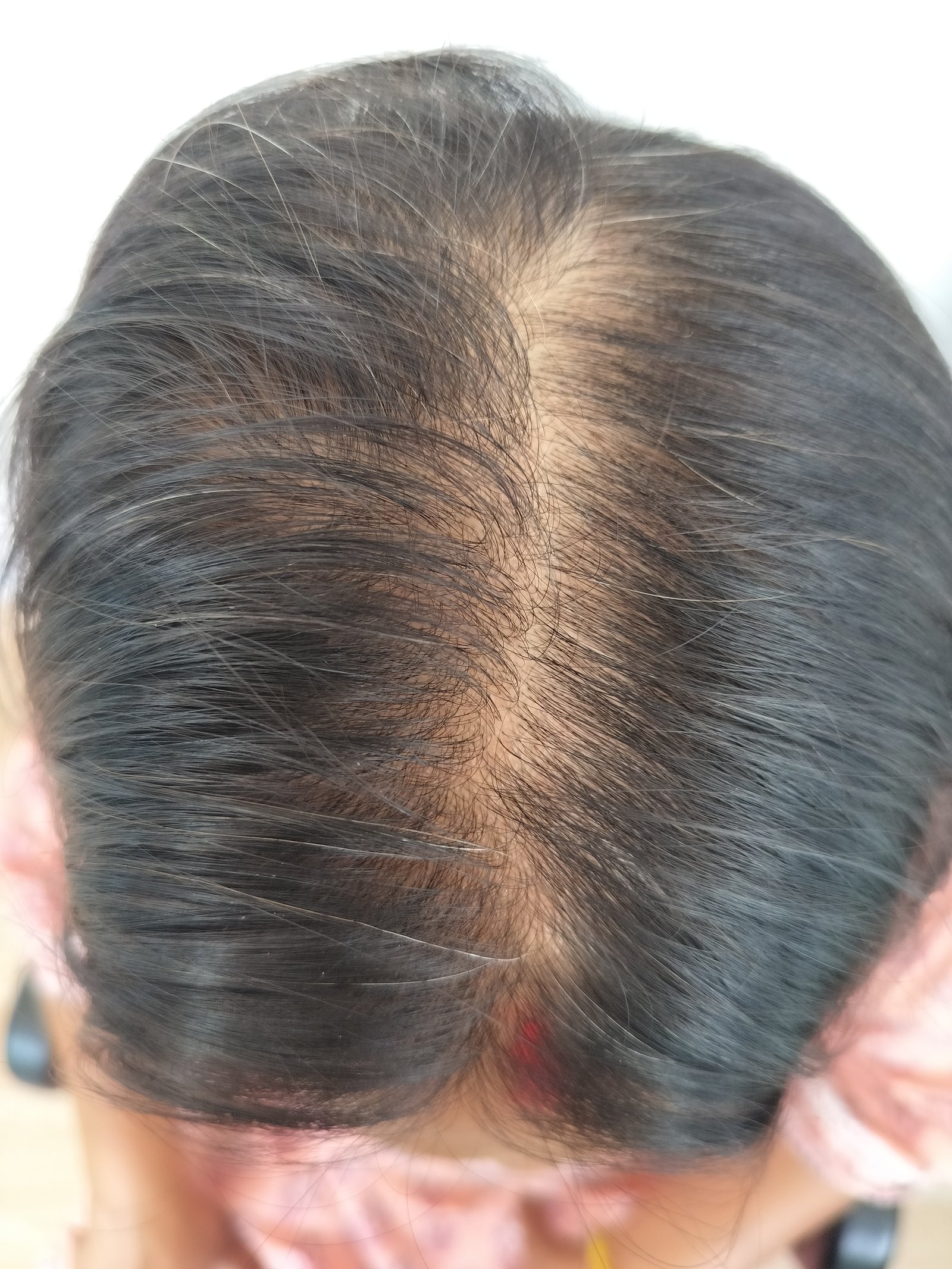 transformation-img-1 transformation-img-1