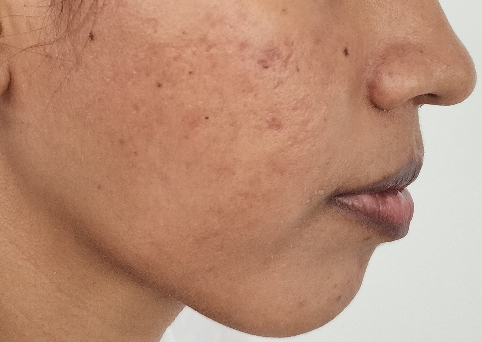 transformation-img-2