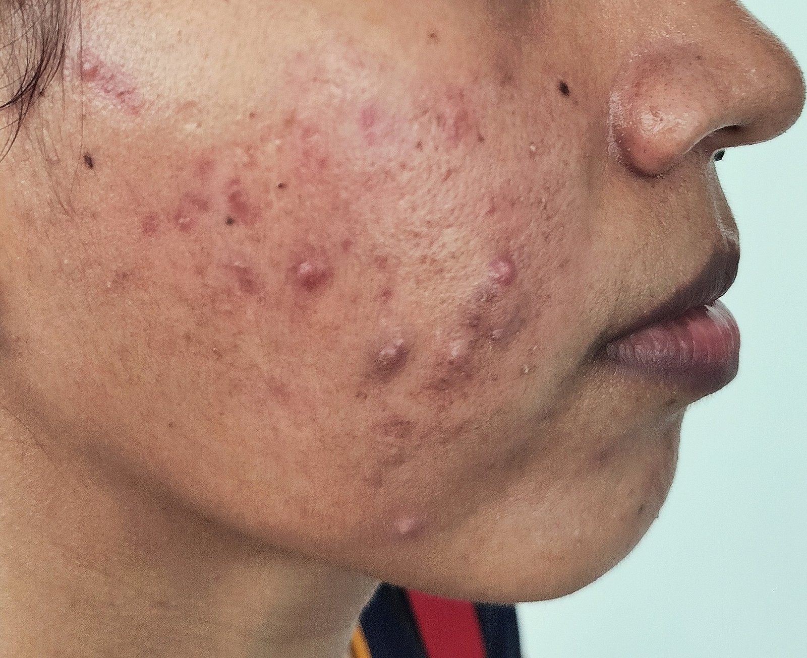 transformation-img-1 transformation-img-1